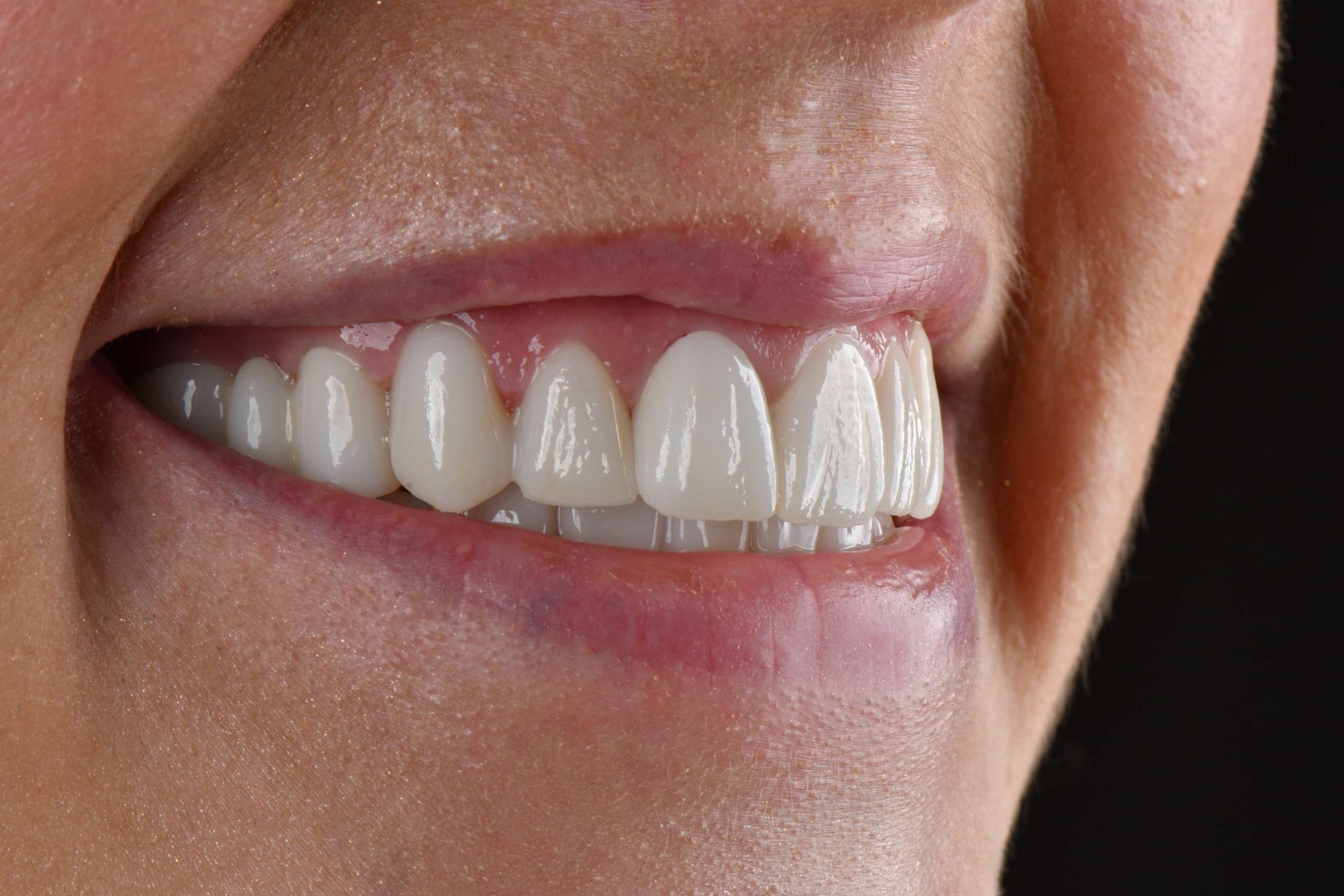 Happy patient photo 1
