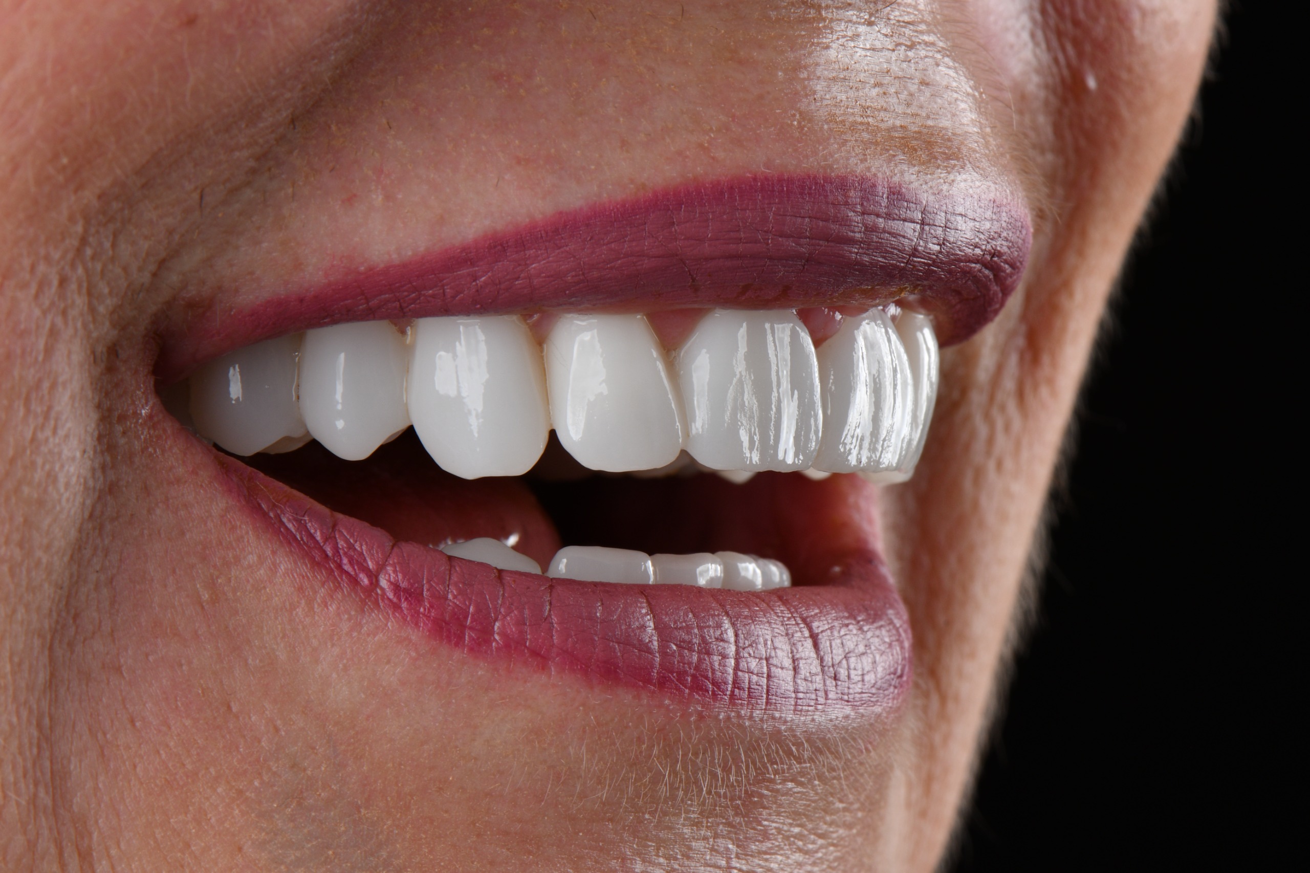 Happy patient photo 2