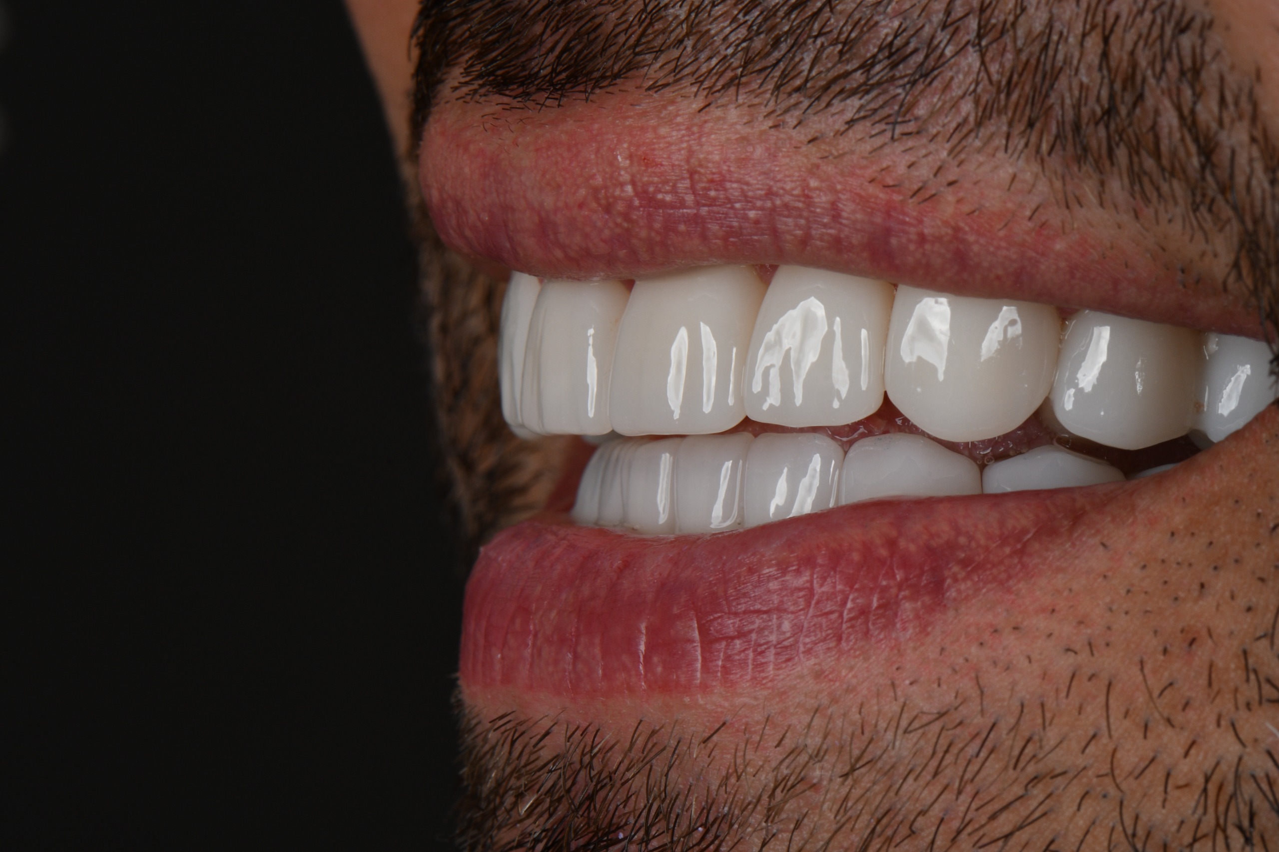 Happy patient photo 5