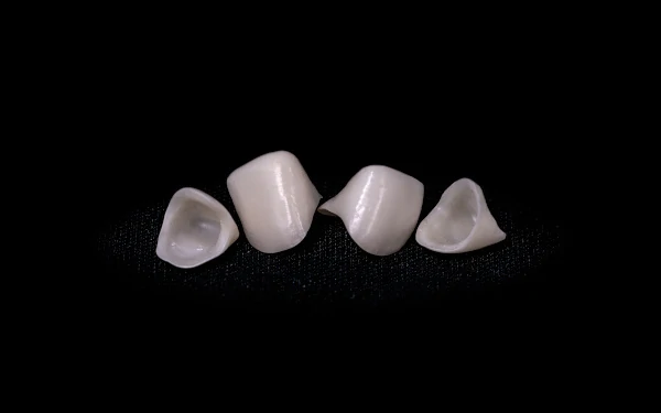 Laminate Veneers 2