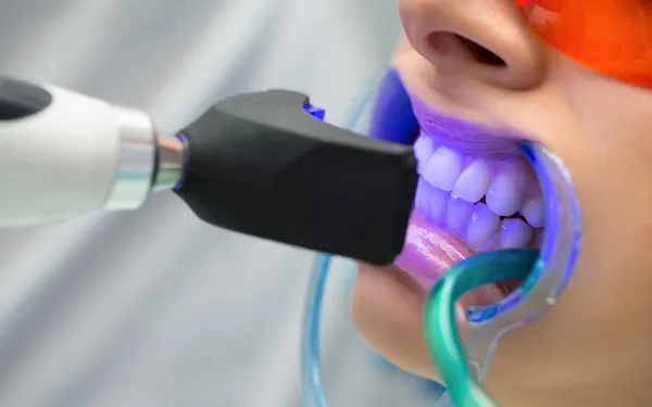 Teeth Whitening
